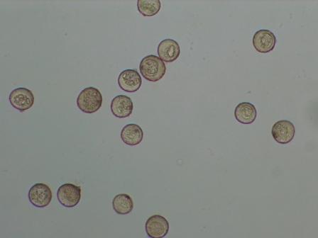 最新 花粉 顕微鏡写真 Saikonomuryogazopure