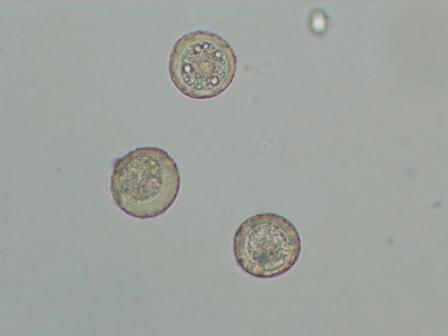 （写真）顕微鏡でみる花粉