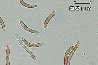 病原菌の胞子写真