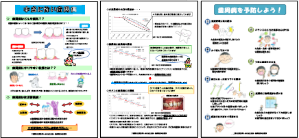 歯周病パネル